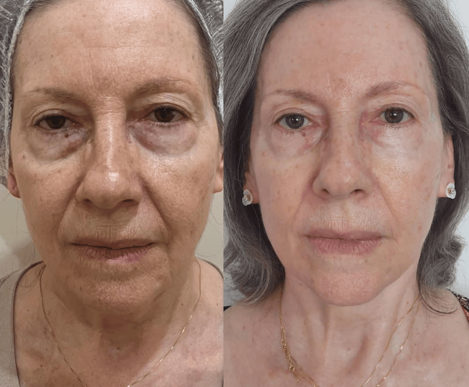 YuvA - Sérum Facial Nutricionalmente Rejuvenescedor