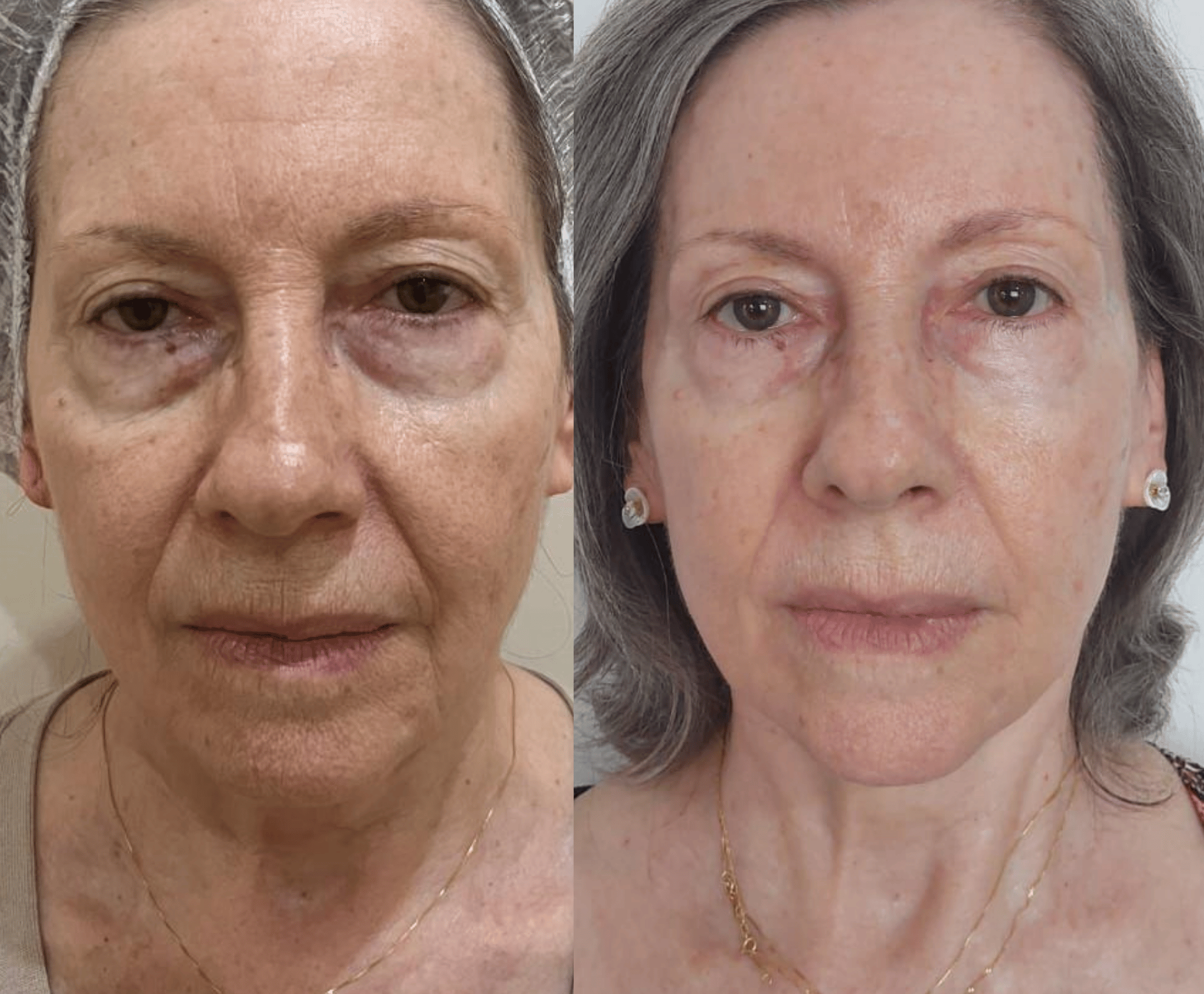 YuvA - Sérum Facial Nutricionalmente Rejuvenescedor