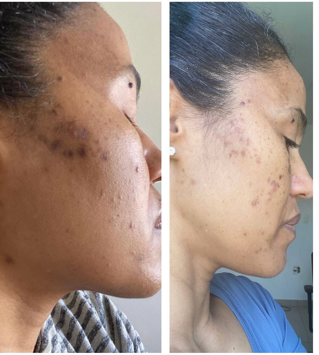 khali - Sérum Facial Uniformizante