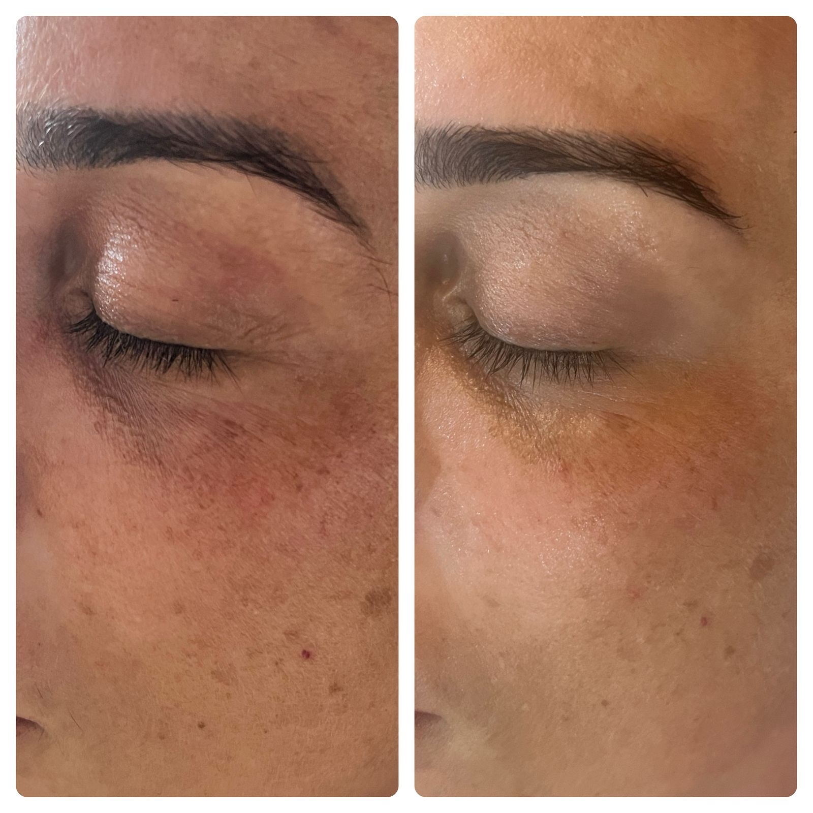 Elakshi - Sérum Nutritivamente Iluminador para Olhos