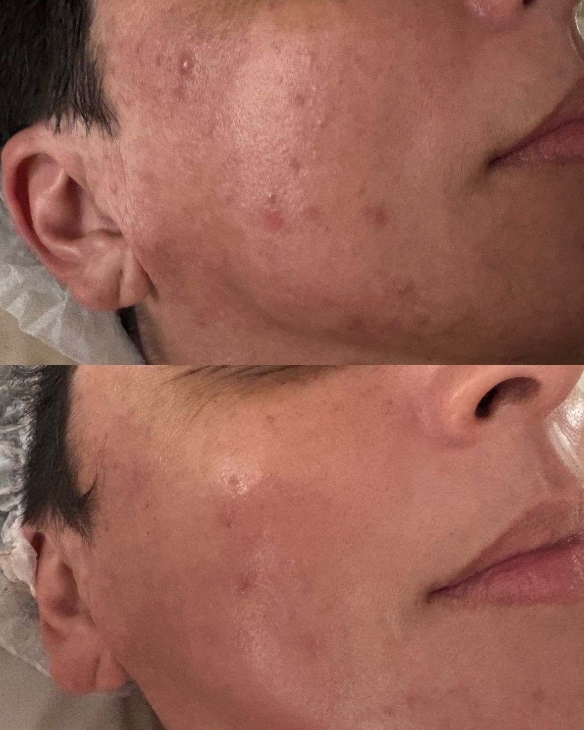 kaSAya - Sérum Facial Regulador